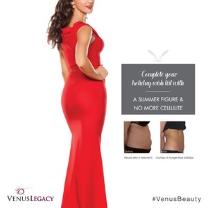 (8) 60 min BODYSCULPTING Photo